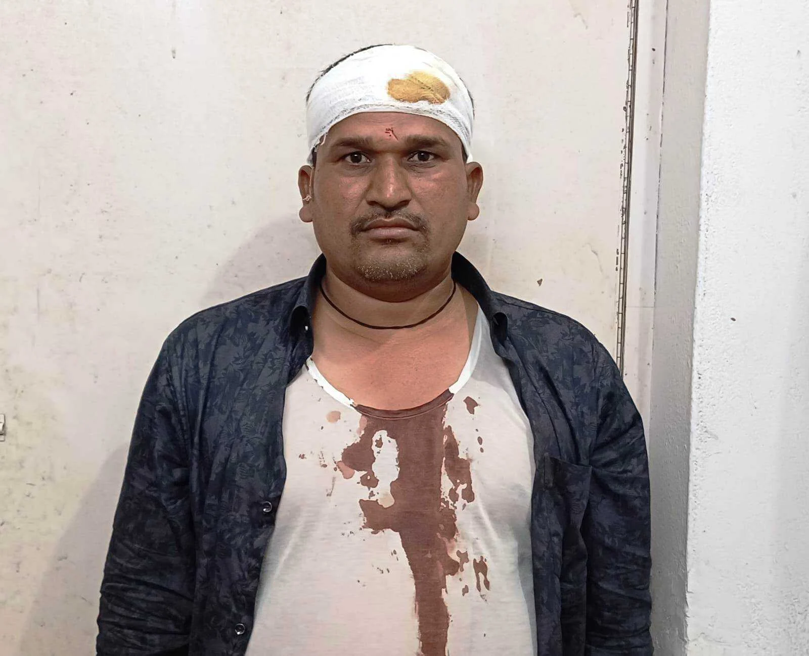 बछवाड़ा में पांच हजार रूपया रंगदारी नहीं देने पर युवक का सिर फोड़ा, गहने और नकदी लूटी 3