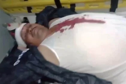 बछवाड़ा में पांच हजार रूपया रंगदारी नहीं देने पर युवक का सिर फोड़ा, गहने और नकदी लूटी 23