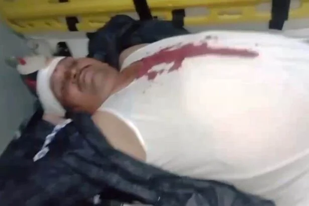 बछवाड़ा में पांच हजार रूपया रंगदारी नहीं देने पर युवक का सिर फोड़ा, गहने और नकदी लूटी 1