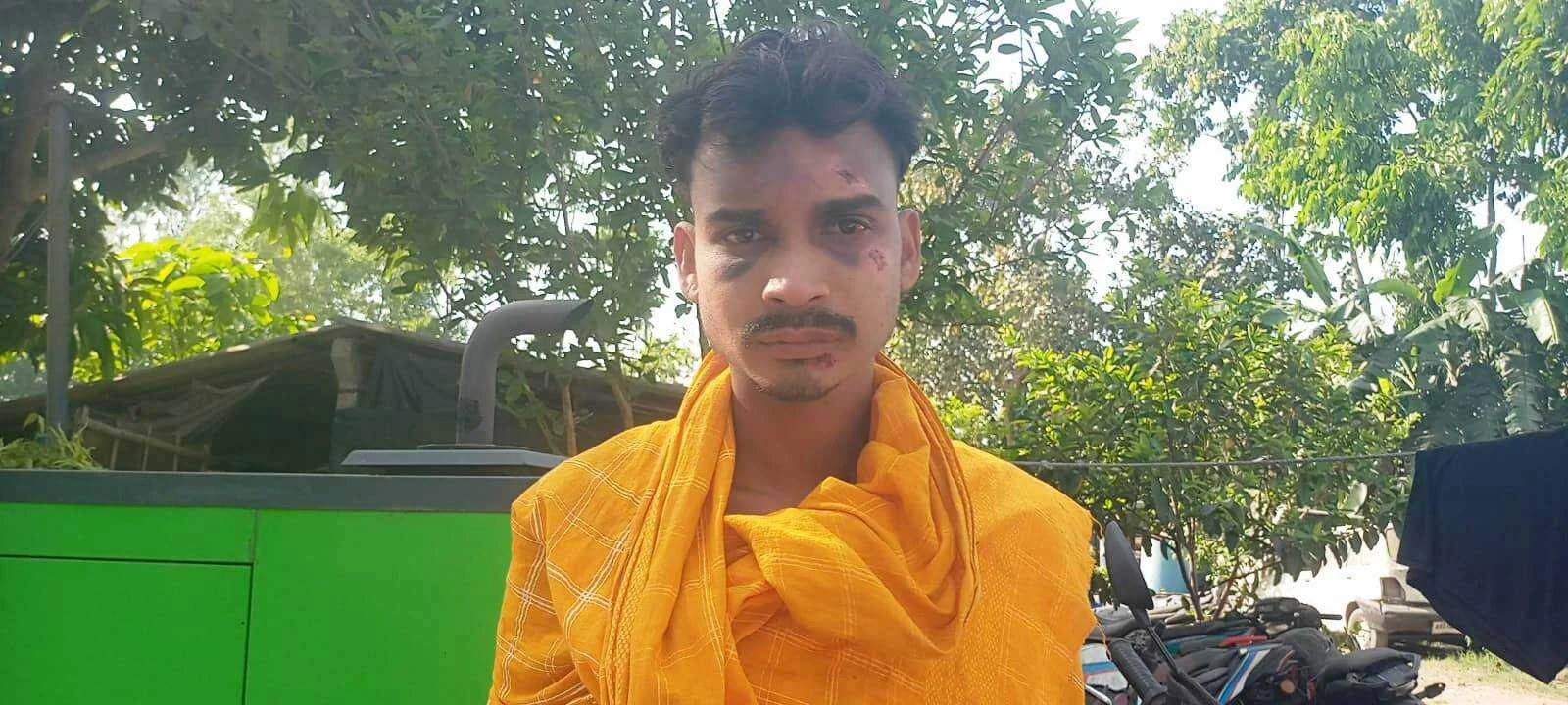 वीरपुर में जमीन बिक्री के पैसे मांगे तो भांजे पर 'फाइटर' से हमला, सगे मामा समेत दो पर केस दर्ज 8