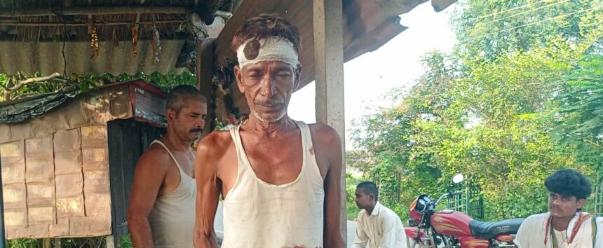 वीरपुर में रत्न मन बभनगामा में घर में घुसकर युवक पर जानलेवा हमला, सात लोगों पर प्राथमिकी दर्ज 1