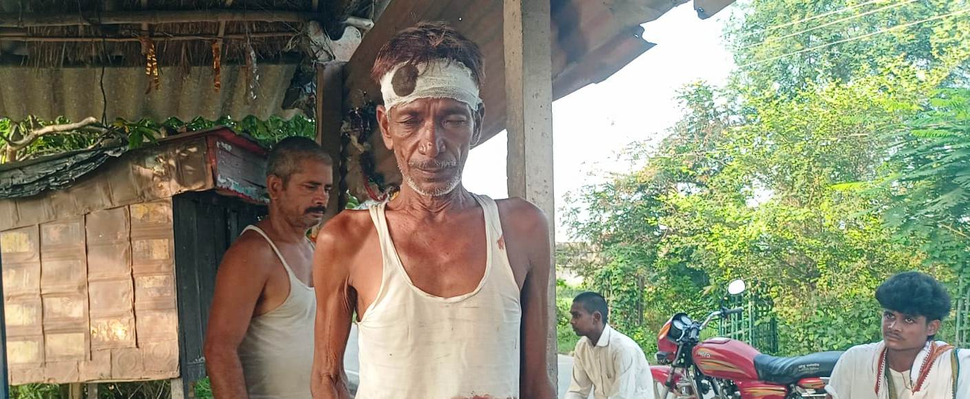 वीरपुर में रत्न मन बभनगामा में घर में घुसकर युवक पर जानलेवा हमला, सात लोगों पर प्राथमिकी दर्ज 6